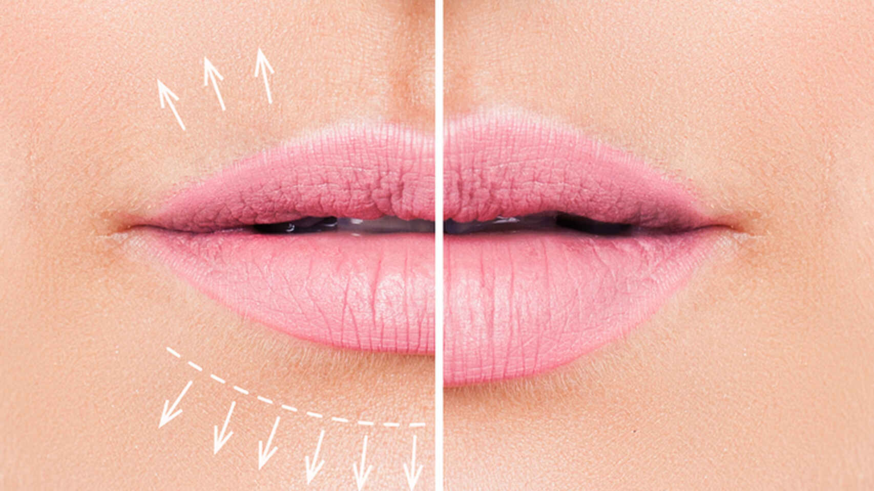 ¿Cómo lograr más volumen en los labios?